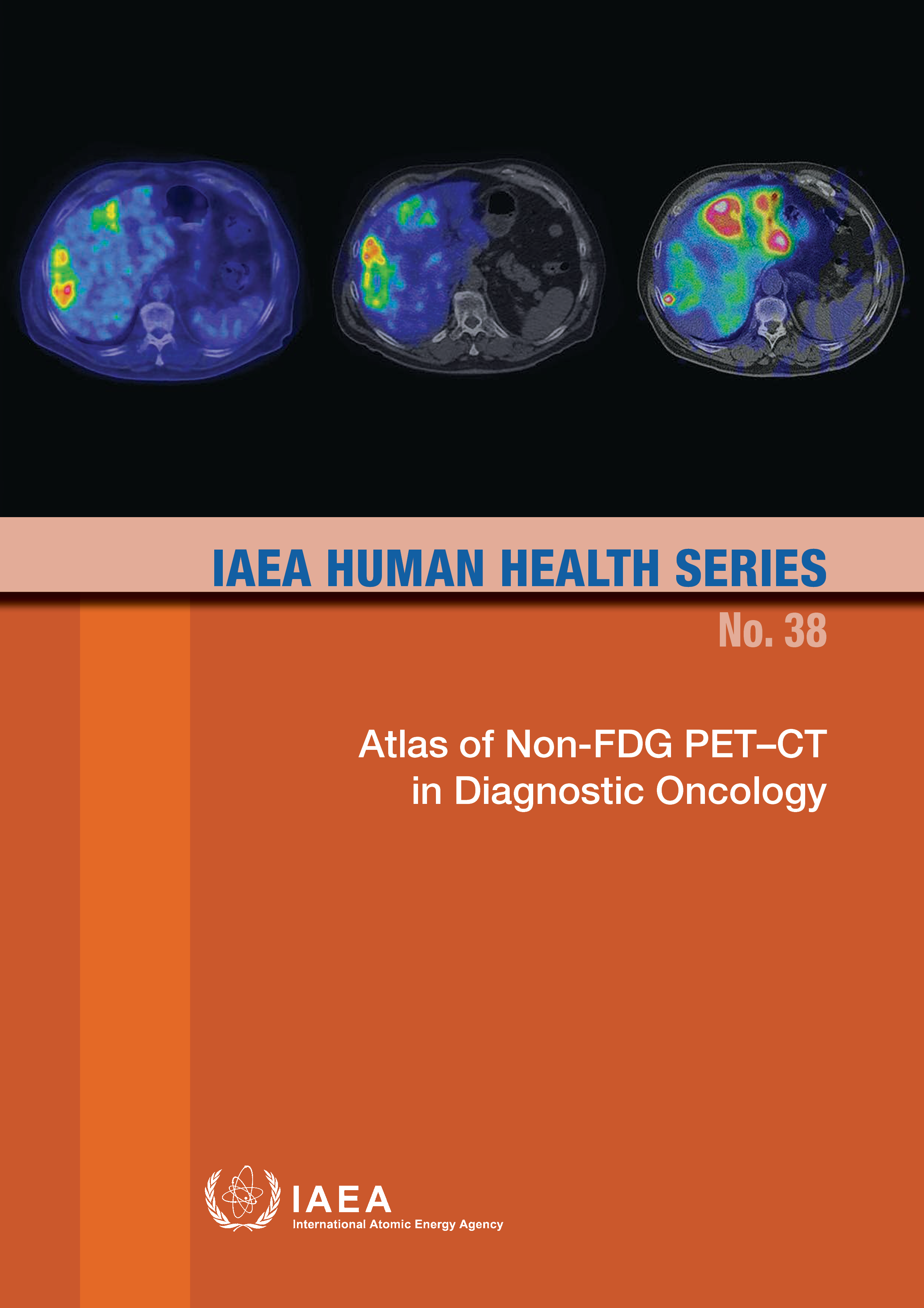 ATLAS OF NON-FDG PETCT IN DIAGNOSTIC ONCOLOGY - photo 1