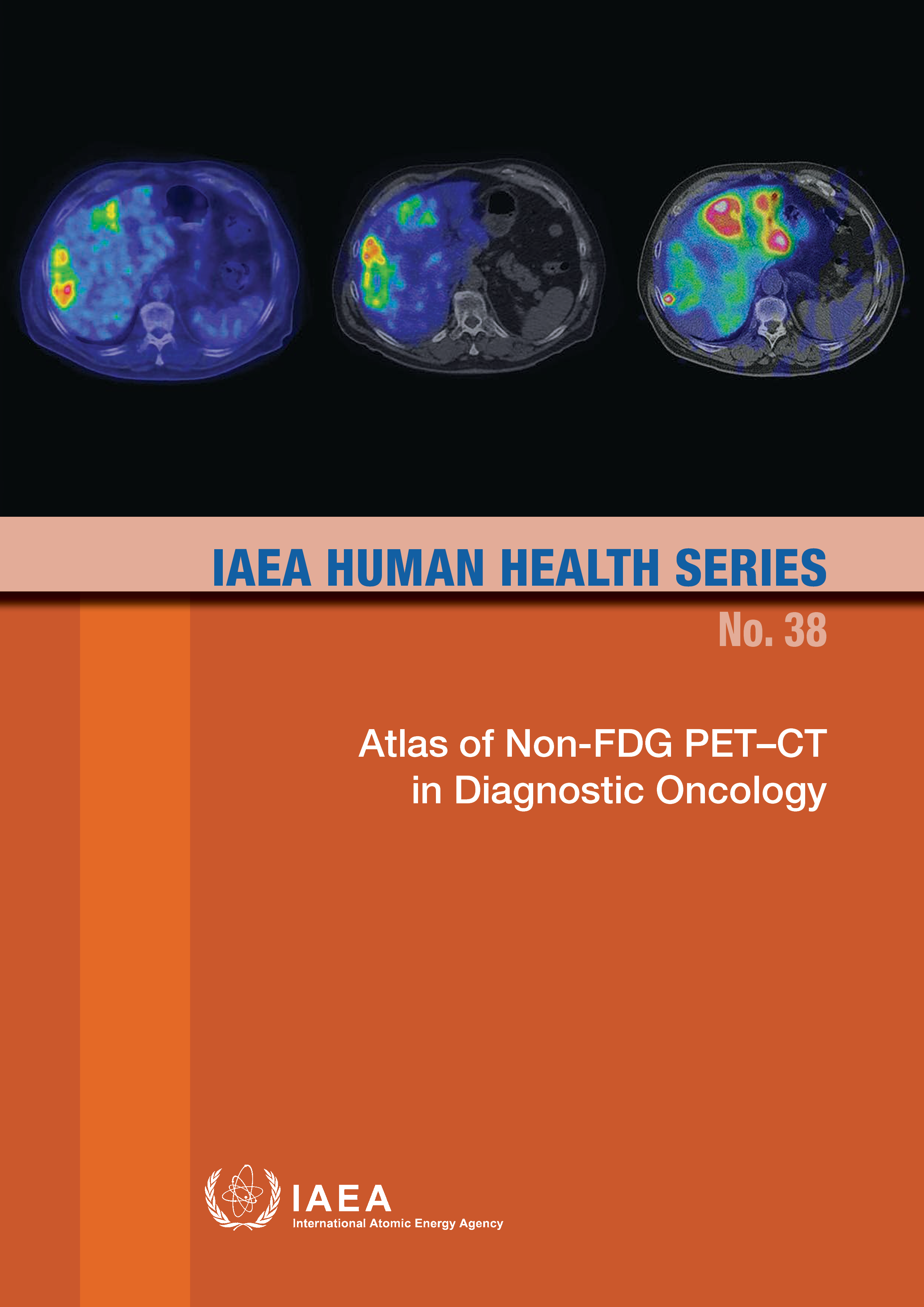 ATLAS OF NON-FDG PETCT IN DIAGNOSTIC ONCOLOGY IAEA HUM - photo 2