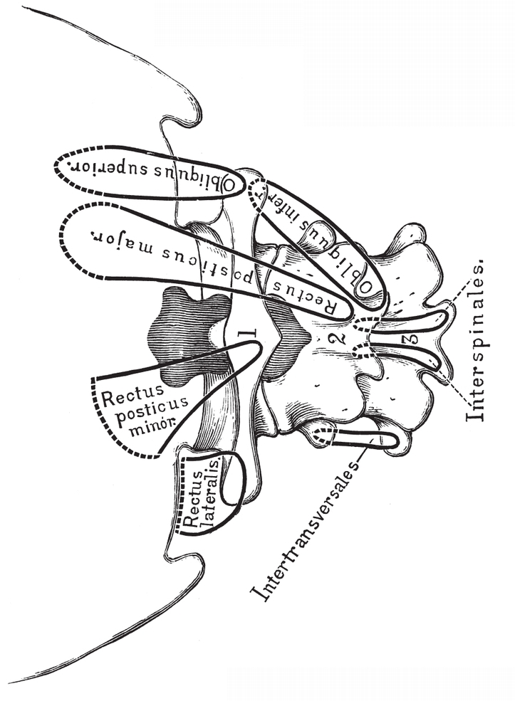 Fig iiOccipital Bone and three first Vertebr Fig iiiFront View - photo 13