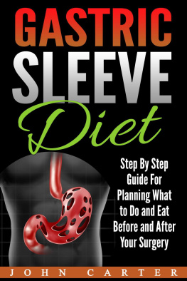 John Carter - Gastric Sleeve Diet: Step By Step Guide For Planning What to Do and Eat Before and After Your Surgery