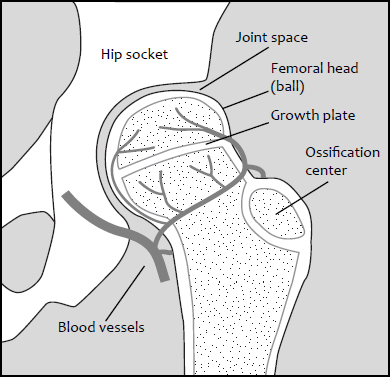 Figure 1 Normal hip anatomy for a child The blood supply to the hip in - photo 7