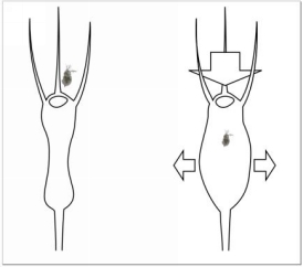 I mage 5 As soon as the prey hits the hairs near the bladder it triggers - photo 10