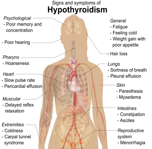 Details You Ought To Know About Hypothyroidism and Its Causes W ithout any - photo 1