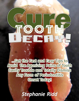 Stephanie Ridd - Cure Tooth Decay!: Get the Fast and Easy Tips to Avoid the Agonizing Pains of Tooth Cavity Trouble and Totally Dismiss Any Form of Periodontitis Onset Today!