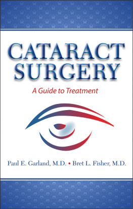 Bret L Fisher Cataract Surgery: A Guide to Treatment