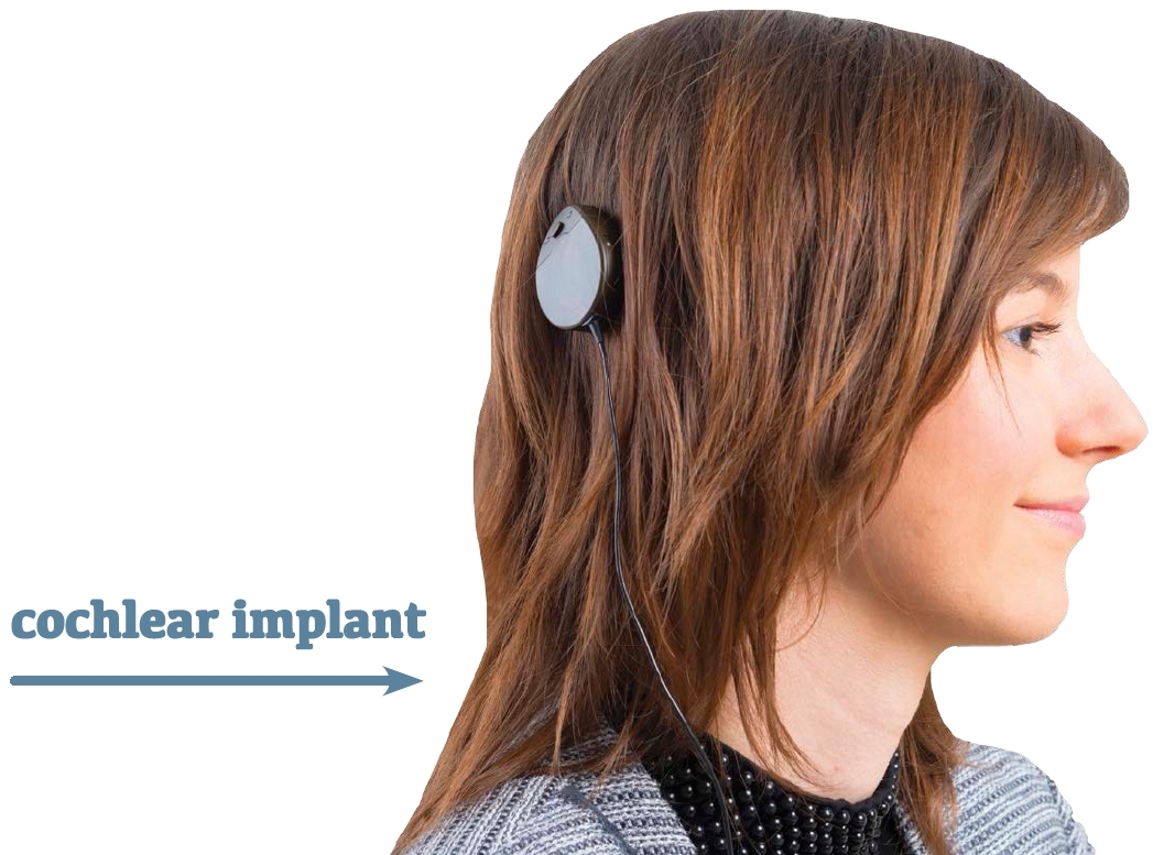 Hearing aids and cochlear implants are devices that help people hear Making - photo 7