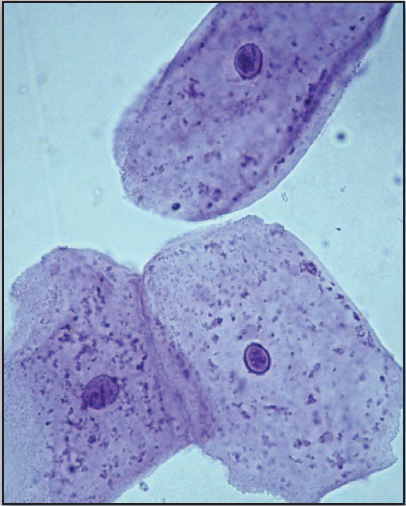 These are cheek cells They are easy to collect from the inside of a persons - photo 5