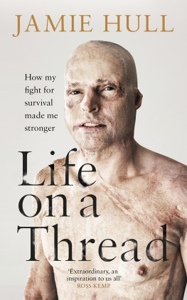 Jamie Hull - Life on a Thread: My story