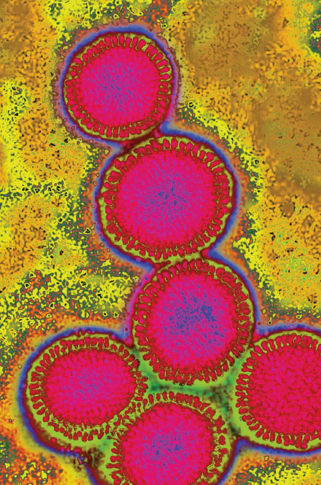 The influenza virus as seen with an electron microscope Infectious disease - photo 3