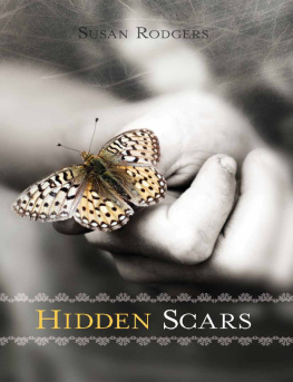 Susan Rodgers - Hidden Scars