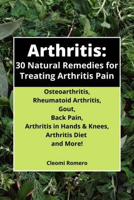 Cleomijo Books - Arthritis: 30 Natural Remedies for Treating Arthritis Pain Osteoarthritis, Rheumatoid Arthritis, Gout, Back Pain, Arthritis in Hands & Knees, Arthritis Diet and More!