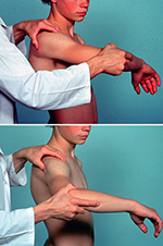 The test is positive as the arm is brought into extension when a sudden jerk or - photo 12