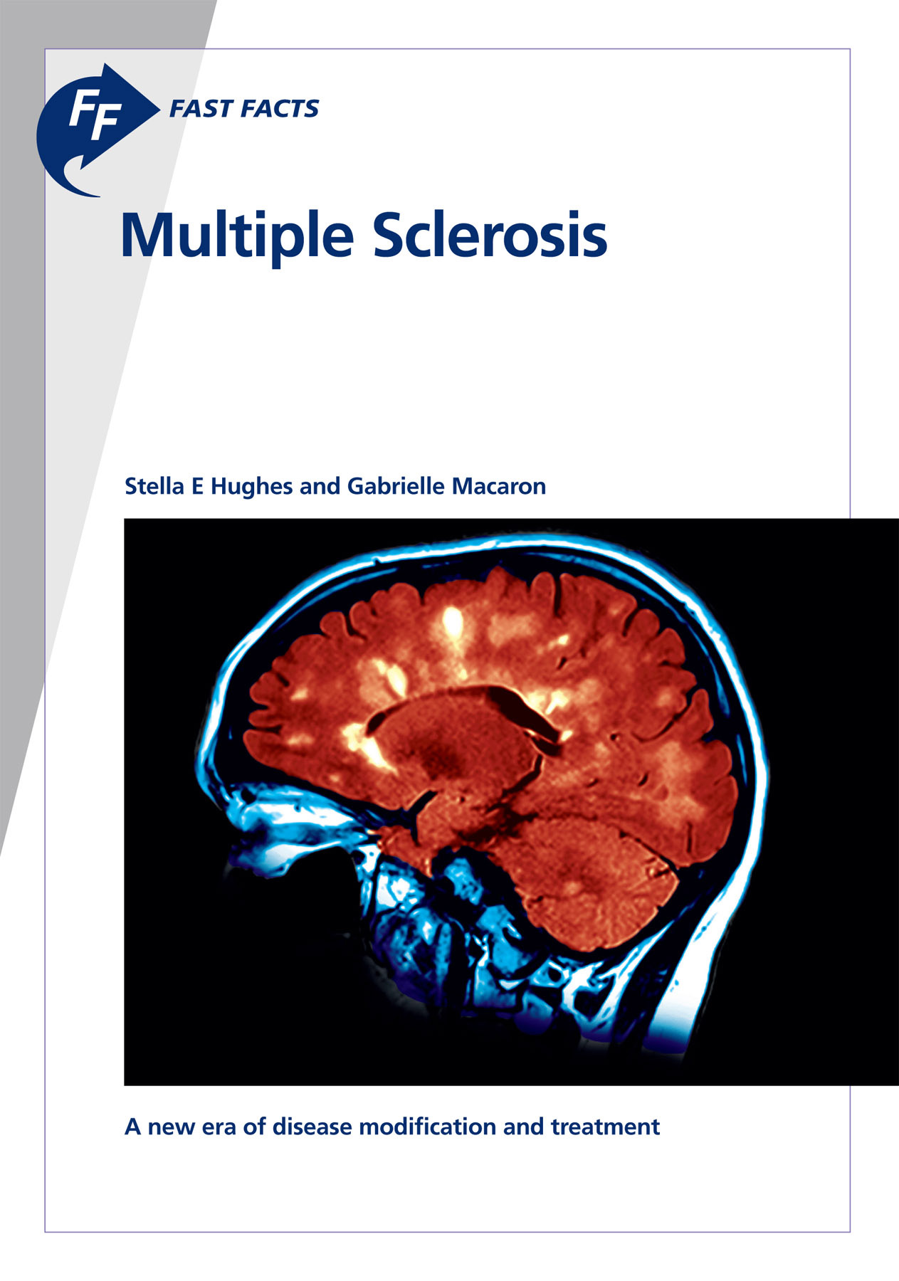 Fast Facts Multiple Sclerosis First published 2000 second edition 2006 third - photo 1