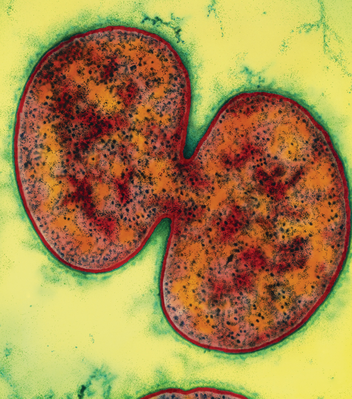 Image Credit Professor Nicholas J Russell Q Why did the bacteria cross the - photo 4