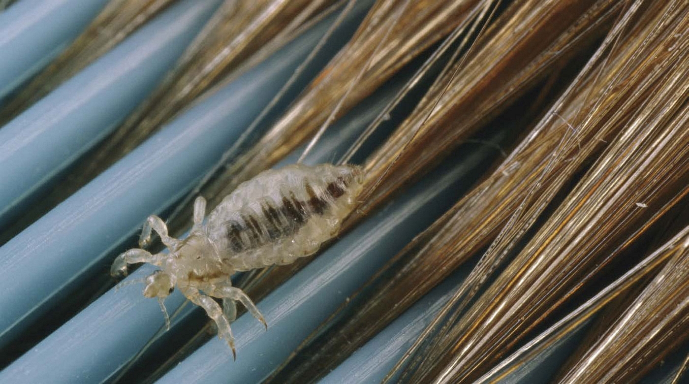 To treat lice a person has to wash their hair with a special shampoo or - photo 4