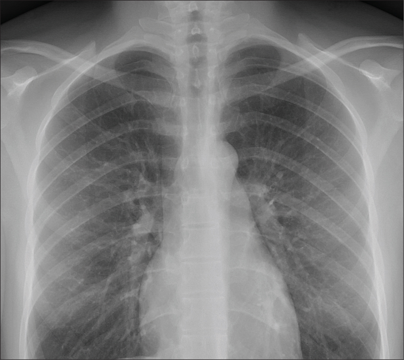 A CHEST X-RAY SHOWING A HUMAN SPINE CAN YOU ALSO SPOT THE RIBS CREDIT MIKAEL - photo 5