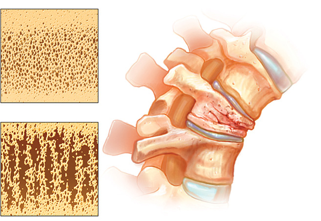 A Acne What is it Acne is a skin condition that occurs when hair follicles - photo 8