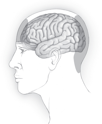 Figure 1 Tension-type headache pain Tension-type headaches often produce - photo 3