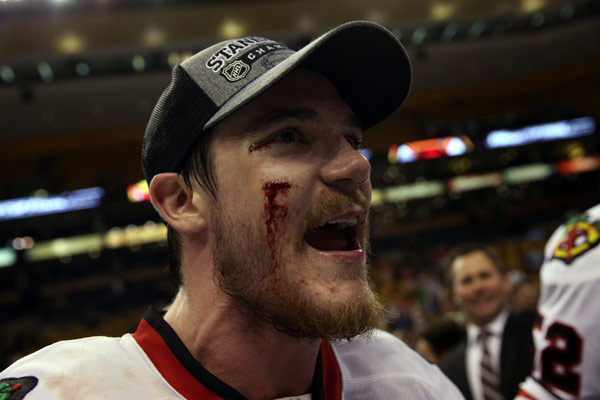 Andrew Shaw who was hit in the face by a puck in the first period but returned - photo 4