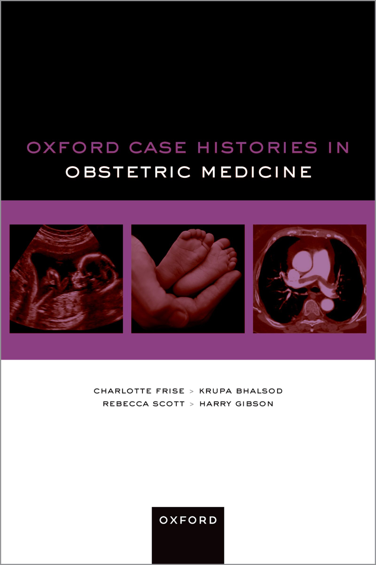 Oxford Case Histories in Obstetric Medicine Oxford Case Histories Series - photo 1