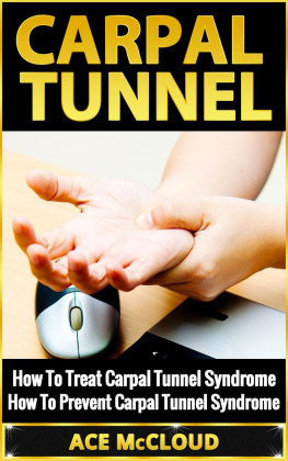 Ace McCloud Carpal Tunnel: How To Treat Carpal Tunnel Syndrome: How To Prevent Carpal Tunnel Syndrome