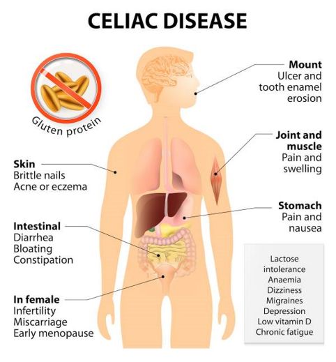 Managing a Gluten-free Diet Whilst it is easy to avoid products that - photo 3