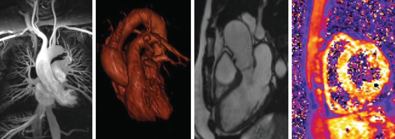 Four M R I images of cardiology training Preface Cardiovascular magnetic - photo 3