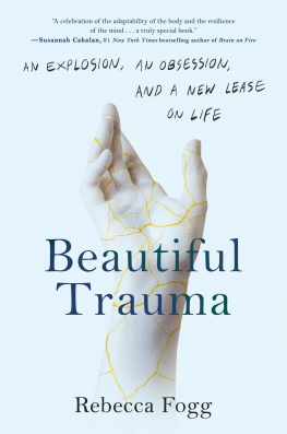 Rebecca Fogg Beautiful Trauma : An Explosion, an Obsession, and a New Lease on Life