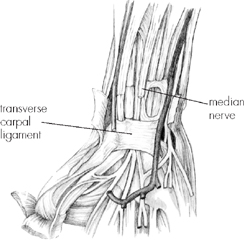 The median nerve runs through the tight space beneath the transverse carpal - photo 5