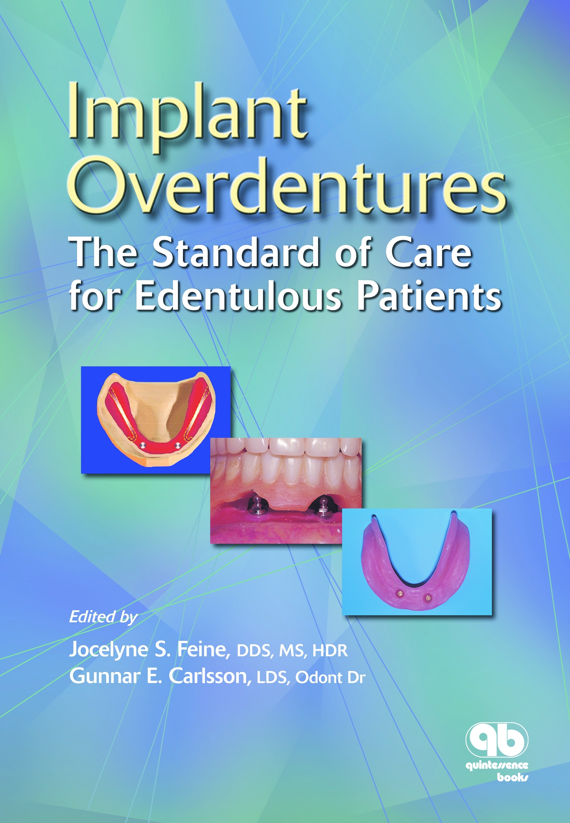 Table of Contents Jocelyne S Feine DDS MS HDR is professor and - photo 1