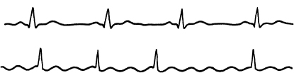 Fig 2 shows the so-called characteristic of a semiconducting element that is - photo 3