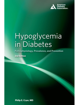 Philip E. Cryer M.D. - Hypoglycemia in Diabetes: Pathophysiology, Prevalence, and Prevention