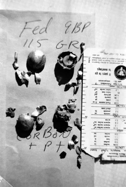 TWO 9MM 115 GRAIN BULLETS recovered from flesh and bone that was alive at time - photo 5