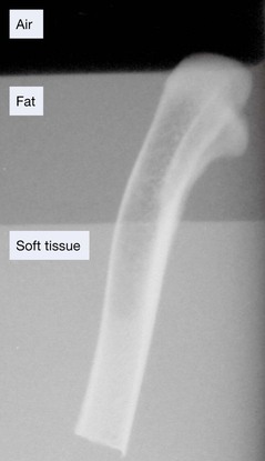 Radiograph of a chicken leg bone partially submerged in a layer of vegetable - photo 3