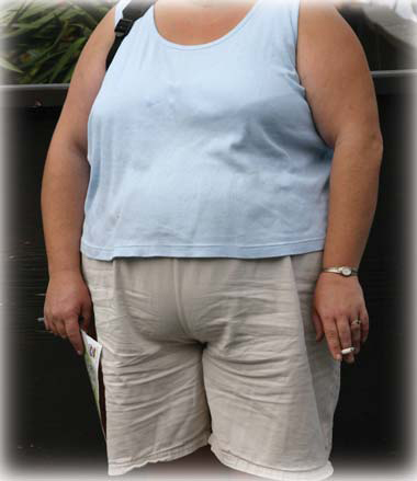 O besity is one of the primary lifestyle diseases of the present century It - photo 2