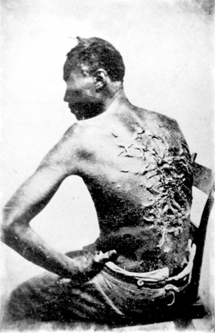 Image Credit Library of Congress Whippings left slaves brutally scarred or - photo 3