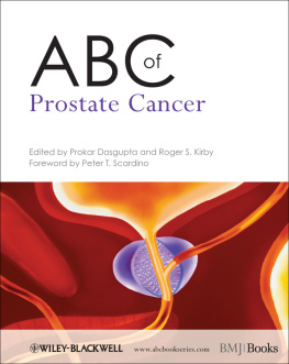 Prokar Dasgupta - ABC of Prostate Cancer