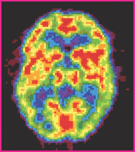 Image Credit Hank MorganScience Source This PET scan of a human brain was - photo 4