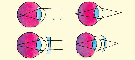 Lenses help the image to form on the retina original lense retina external aid - photo 13