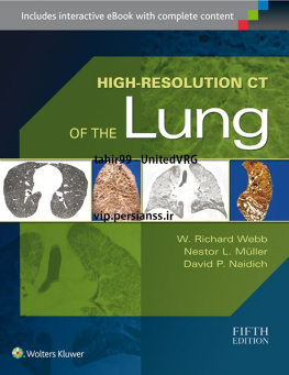 W. R. Webb High-Resolution CT of the Lung