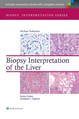 Michael Torbenson MD - Biopsy Interpretation of the Liver