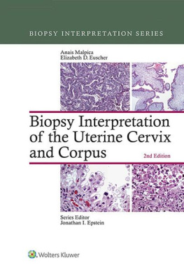 Anais Malpica MD Biopsy Interpretation of the Uterine Cervix and Corpus