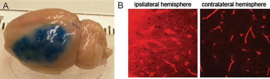 Fig 3 a An example of BBB disruption after rat focal cerebral ischemia at - photo 3