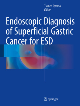 Tsuneo Oyama (ed.) - Endoscopic Diagnosis of Superficial Gastric Cancer for ESD