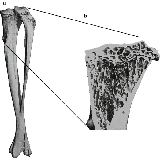 Fig 11 Illustration of compact and cancellous bone a Whole tibial - photo 1