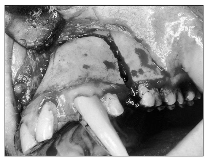 Fig 1-1a Anterior maxillary osteotomy performed after reflection of the labial - photo 3