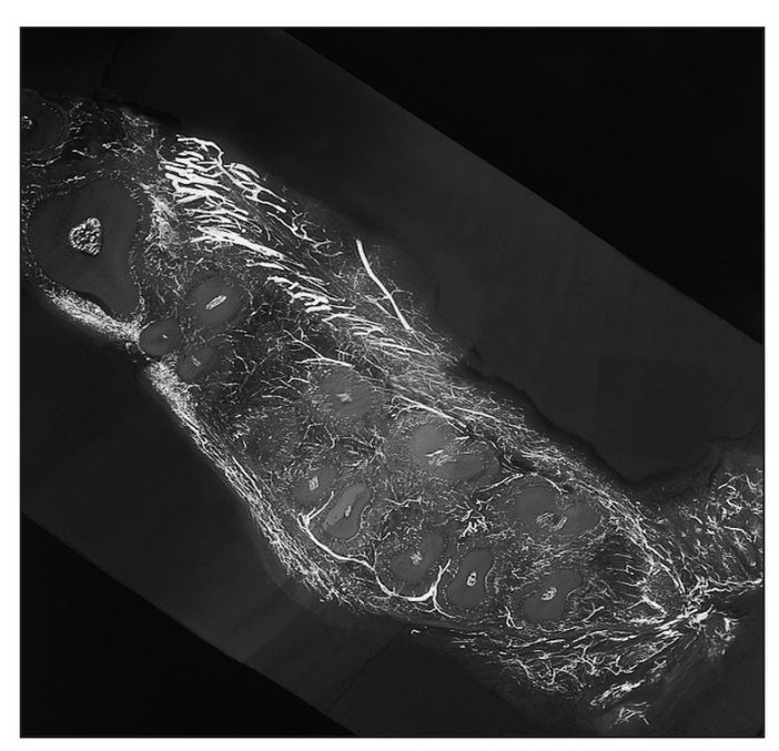 Horizontal microangiogram demonstrating the vascular pattern of a control - photo 6