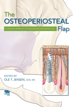 Ole T. Jensen The Osteoperiosteal Flap: A Simplified Approach to Alveolar Bone Reconstruction