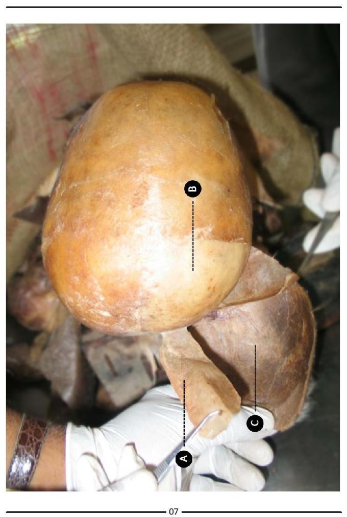 Colour Atlas of Human Anatomy - photo 15