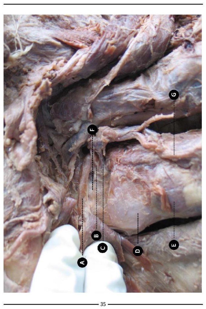 Colour Atlas of Human Anatomy - photo 43